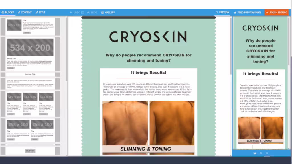 CryoSkin email template highlighting results with before-and-after images showcasing slimming and toning effects.